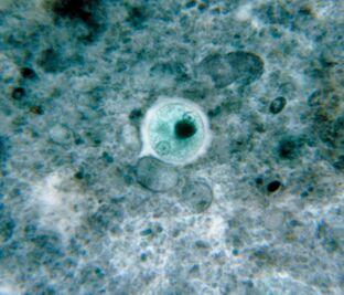 Dysentery amoeba