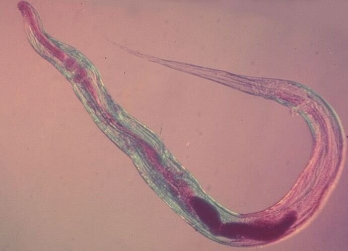 Pinworm under the microscope