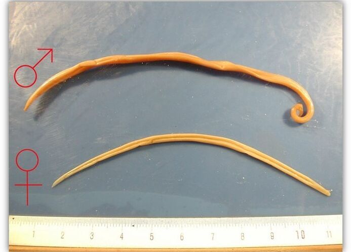 The size of roundworms-worms that affect the respiratory tract of adults