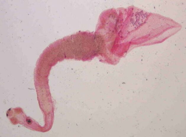 Pork tapeworms from humans