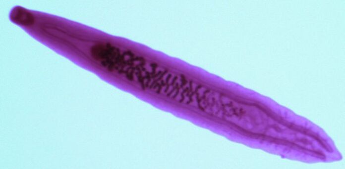 fluke parasites from humans