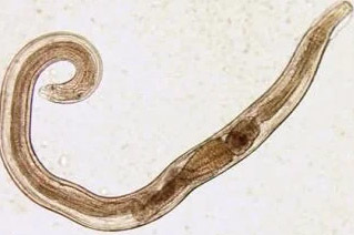 parasites of the human pinworm